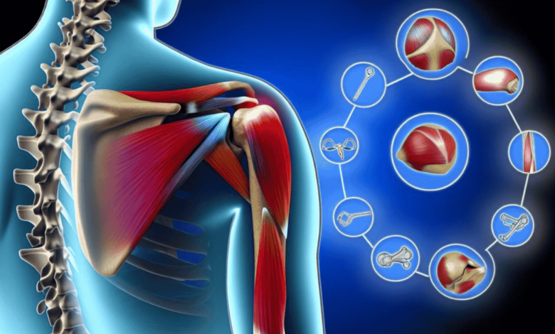 Rotator Cuff Tear