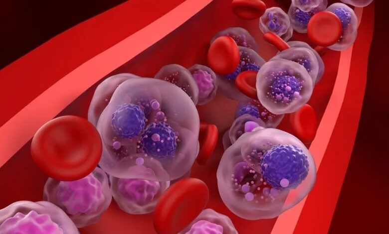 Breakthroughs In Multiple Myeloma Treatment