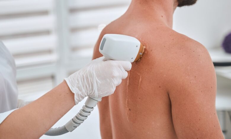 Why Full Body Laser Hair Reduction Is the Smartest Investment in Long-Term Grooming