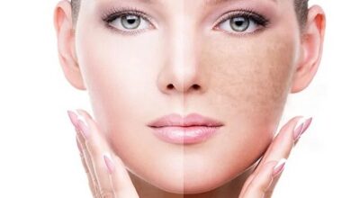 Dermatologist-Created Pigmentation Treatment Brought to Your Door Lavié’s Advantage