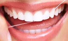 Floss