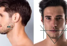 Jawline Fillers
