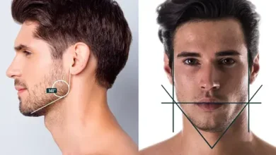 Jawline Fillers