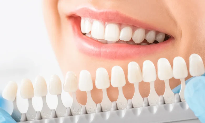Cosmetic Dentistry