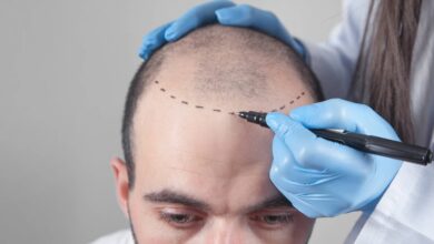 Medical Tourism - Hair Transplant Turkey