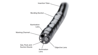 Smooth Insertion, Gentle Pressure: Essentials of Endoscopic Delivery