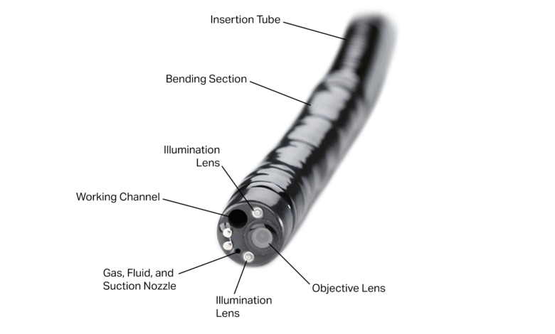 Smooth Insertion, Gentle Pressure: Essentials of Endoscopic Delivery