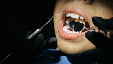 Dental Implants