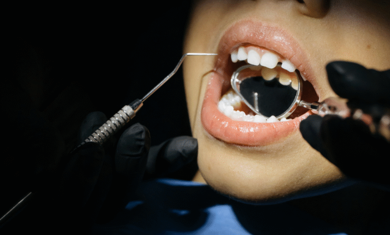 Dental Implants