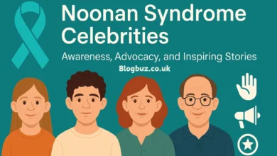 celebrities with noonan syndrome