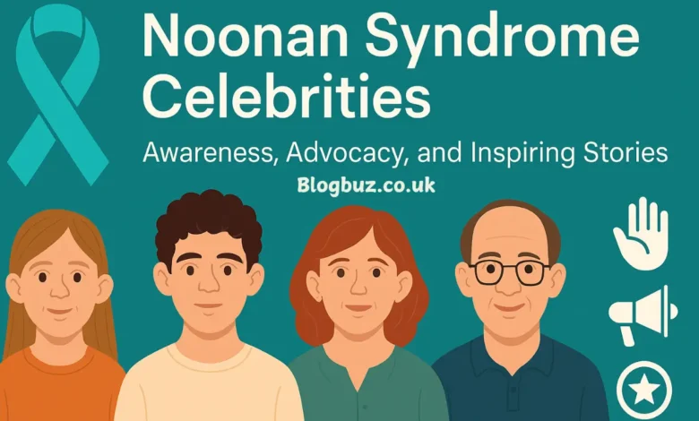 celebrities with noonan syndrome
