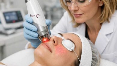 Fraxel Laser