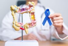 Colorectal Cancer Screening