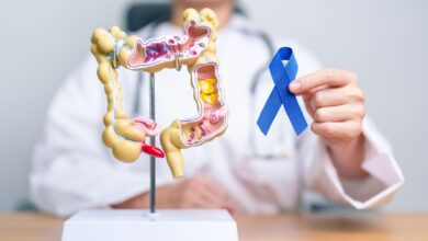 Colorectal Cancer Screening