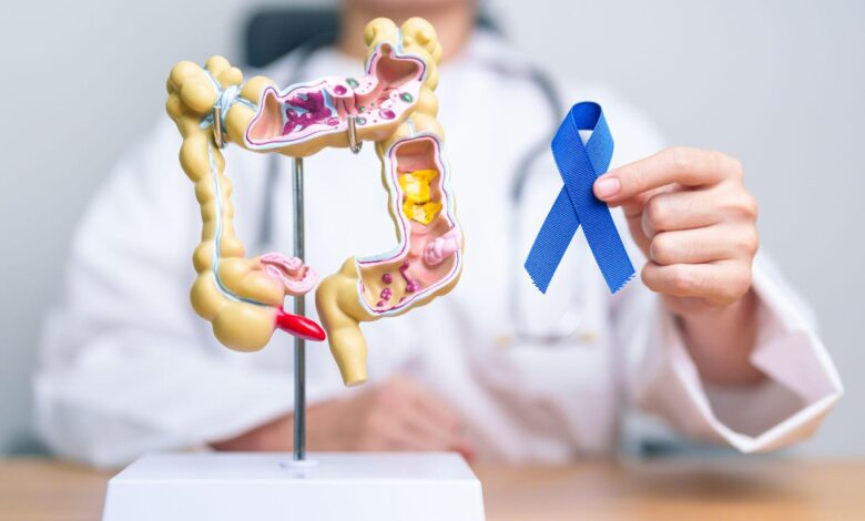 Colorectal Cancer Screening