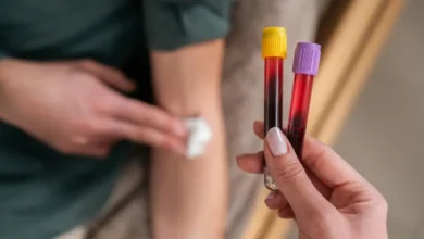Biomarkers