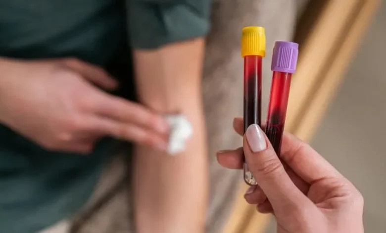 Biomarkers