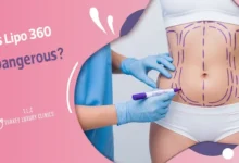 Quantum Ultrasonic Lipo 360