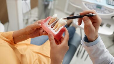 Dental Implant Newcastle