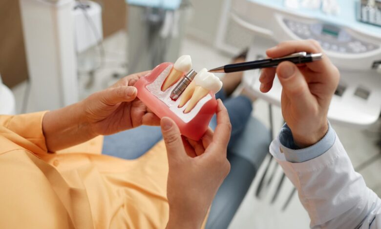 Dental Implant Newcastle