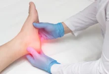 Heel Pain